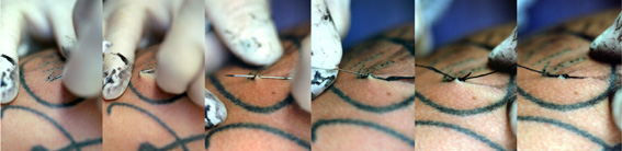 Tatovering med sy-teknik